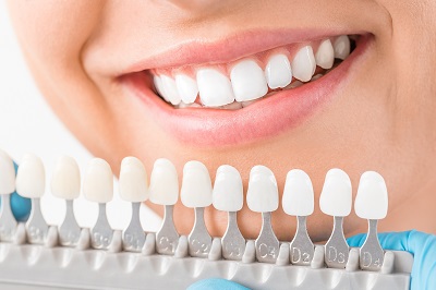 3 Ways for prepping teeth for veneers