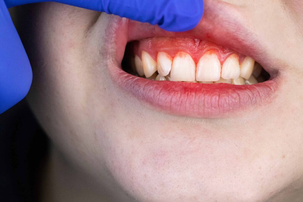 How Much Does Periodontal Cost?